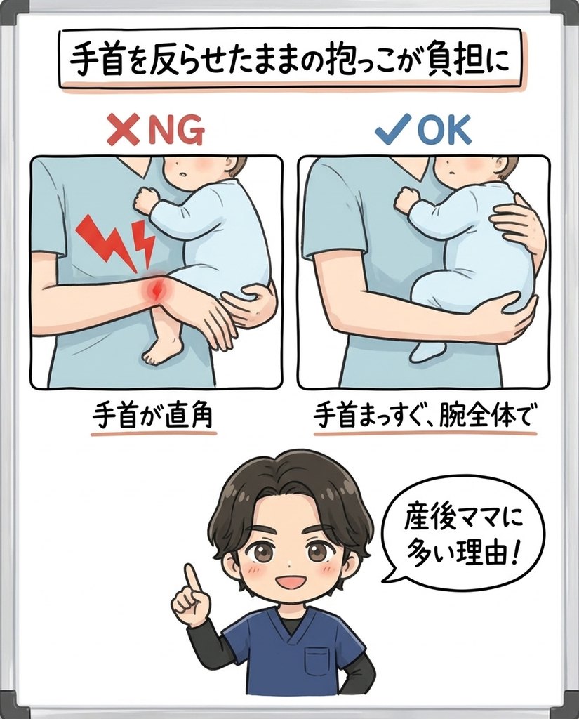 岩倉市・一宮市のいわくら肩甲骨骨盤接骨院による抱っこの手首の角度と腱鞘炎の負担の図解イラスト