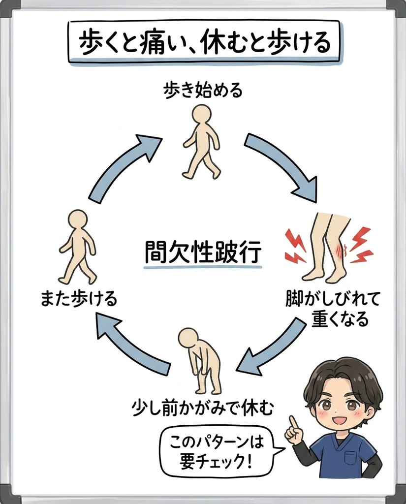 岩倉市・一宮市のいわくら肩甲骨骨盤接骨院による間欠性跛行（歩くと痛い・休むと歩ける）のサイクル図解イラスト