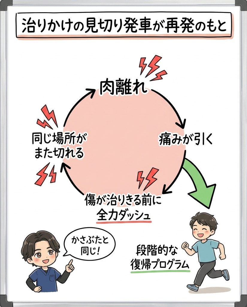 岩倉市・一宮市のいわくら肩甲骨骨盤接骨院による肉離れの再発ループ（治りかけの復帰で再断裂）の図解イラスト