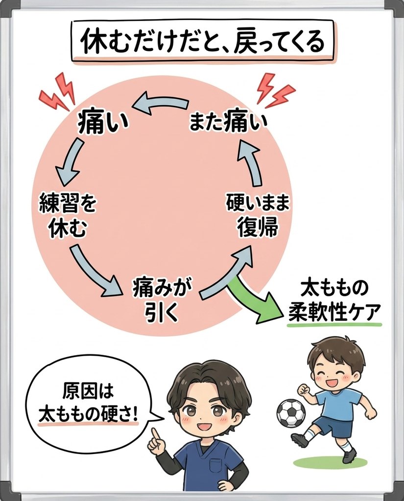 岩倉市・一宮市のいわくら肩甲骨骨盤接骨院によるオスグッド病は休むだけでは再発する理由の図解イラスト