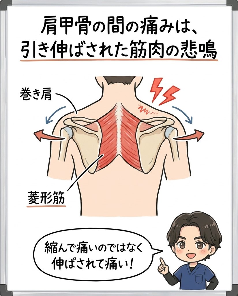 肩 甲骨 の 間 の 背骨 が 痛い