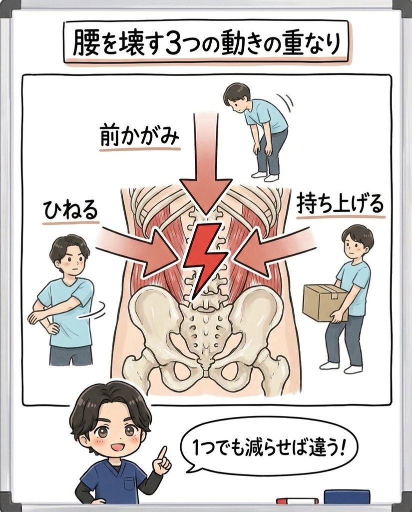 岩倉市・一宮市のいわくら肩甲骨骨盤接骨院による、前かがみ・持ち上げる・ひねるの3つが重なって腰を痛める仕組みの図解イラスト