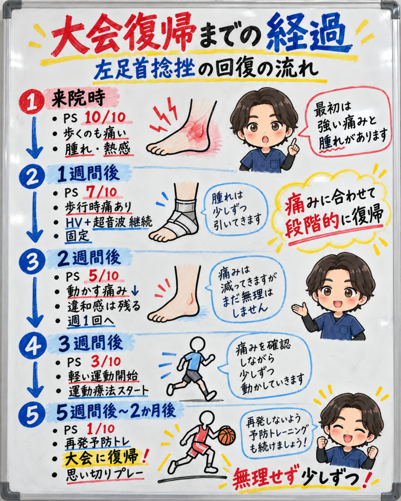 左足首捻挫の回復経過をまとめた図。来院時から1週間後、2週間後、3週間後、5週間後〜2か月後までの痛みの変化、施術の流れ、運動再開、大会復帰までを示したホワイトボード風インフォグラフィック
